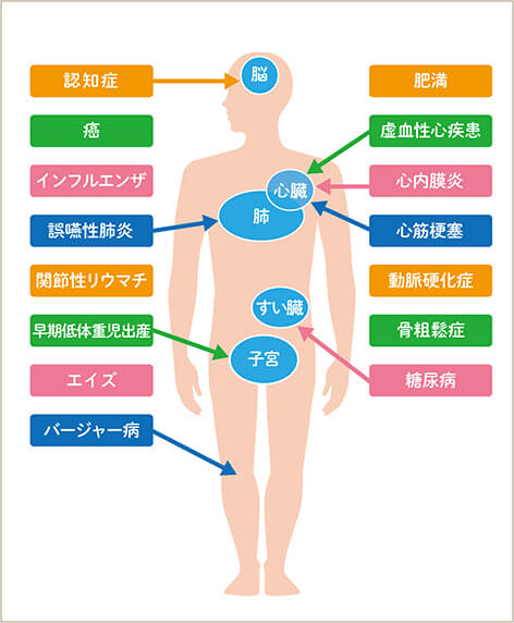 歯周病による身体への影響